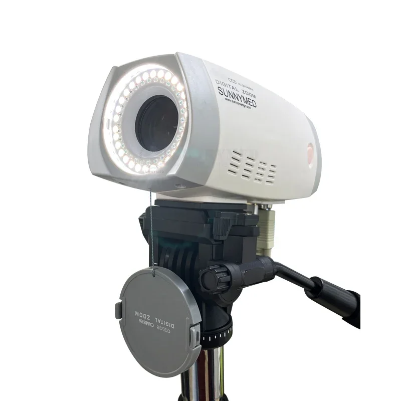 SY-F005HD-1 Digital  Gynecology Examination video Colposcopy for Clinic