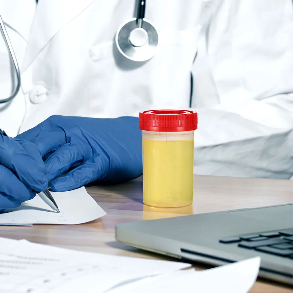 

50 Pcs Stool Cup Urine Pee Cups for Testing with Lids Disposable Specimen Pp Plastic