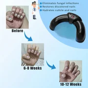 

1/2/4 Pcs Nail Fungus Light Device for Multiple Fingernails & Toenails