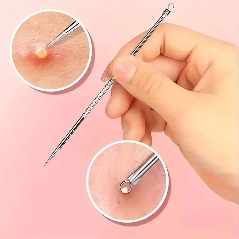 Stainless Steel Blackhead Remover: Pimple Popper Tool for Blemish, Whitehead, and Acne Removal - Suitable for Normal Skin