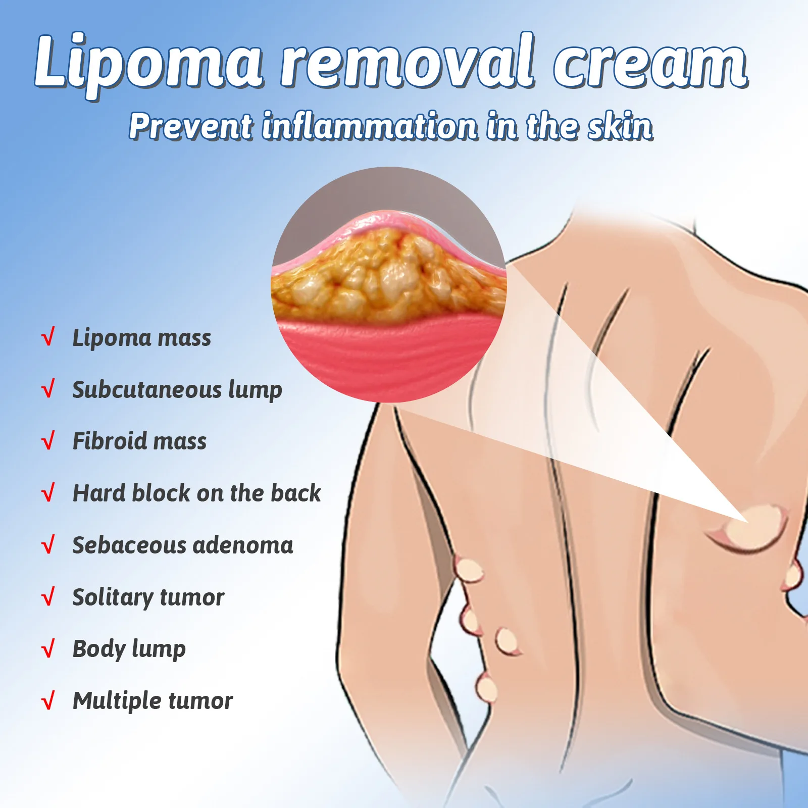 Cellulite Swelling Treatment Cream Subcutaneous Lump Fat Mas Removal Relief Lipoma Pain Anti-Tumor Remove Lump Nodule Ointment