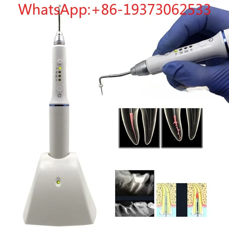 Filled Tooth Glue Tip Oral Root Canal Filling Hot Melt Pen Heating Cutter Heat Carrier