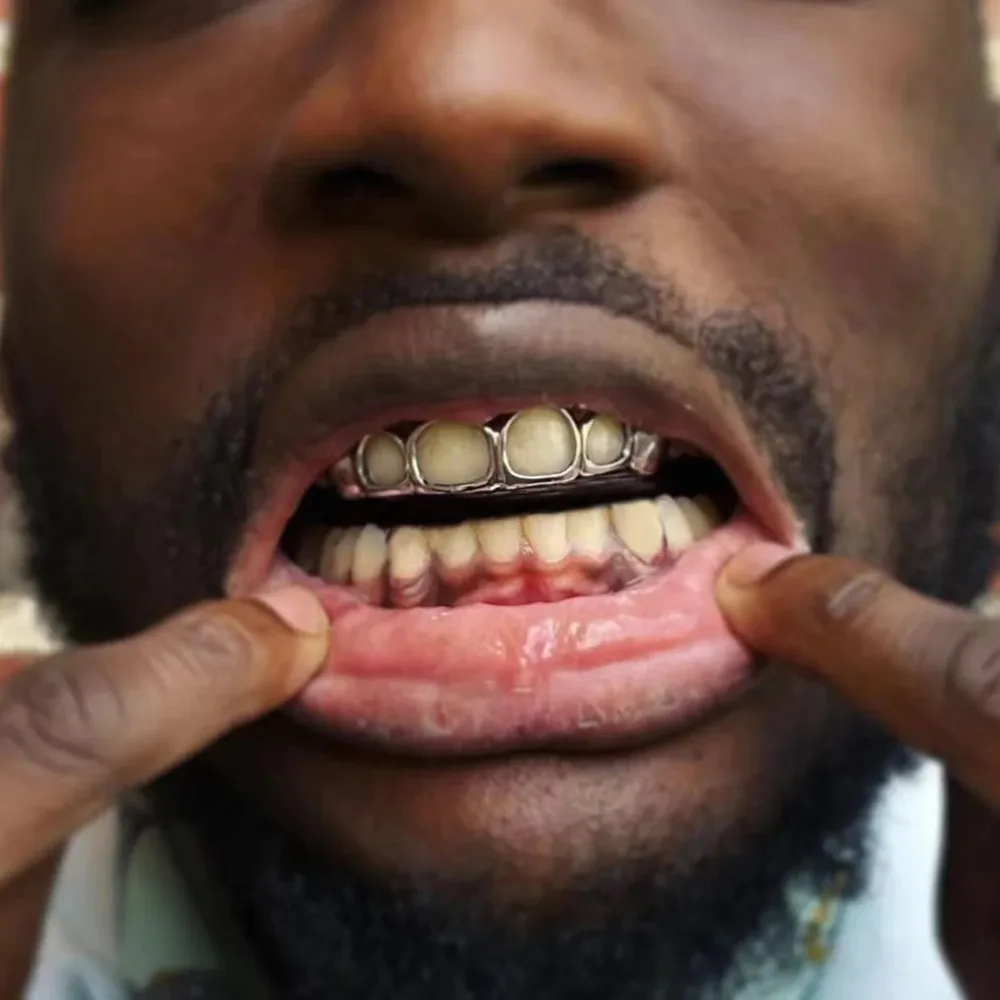 Klassische 4-Hohlzahn-Grillz 6/6 Set Hip-Hop Gold Silber Siebenfarbige Zahnkappen Unisex-Schmuck für Cosplay – Detail 19