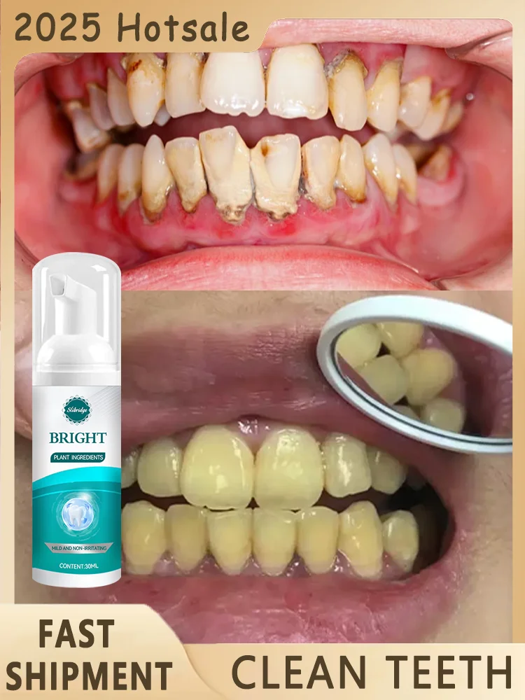 

Teeth cleaning care tools,hot sale oral foam,Fresh Breath,Free shipping