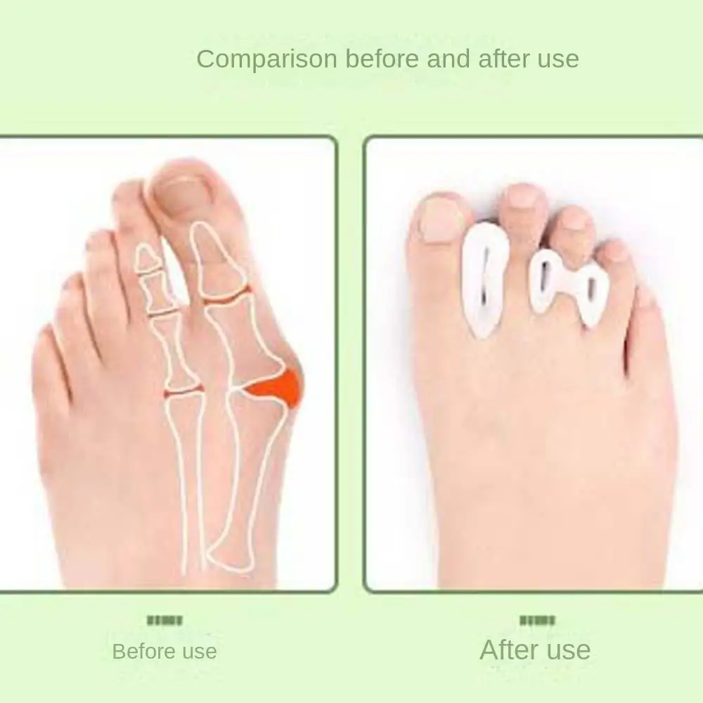 Feet Bone Thumb Adjuster Three Holes Toe Separators Toe Valgus Protector Foot Care Tools Three Holes Toe Straightener SEBS