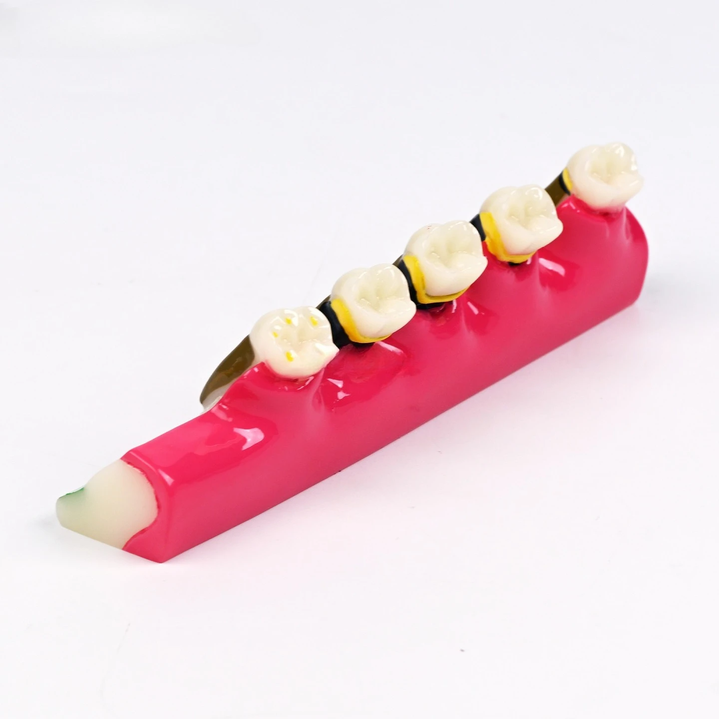 

Periodontitis model Adult periodontal evolution Tooth model