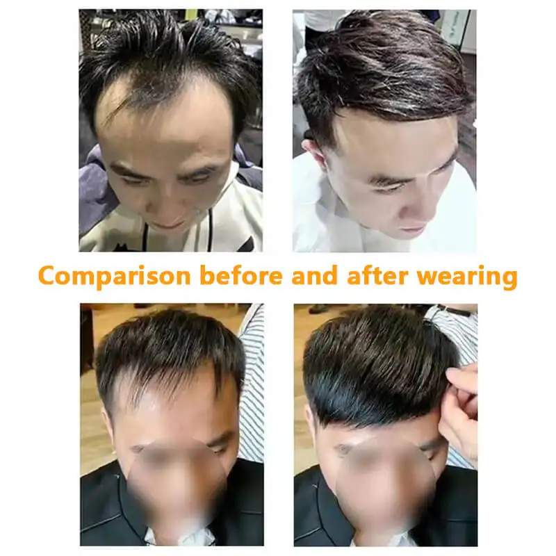 Male Hair Prosthesis Silicone Microskin Base 100% Human Hair Replacement Mens Toupee Breathable Biological Scalp Wigs For Men