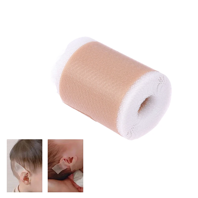 1.5m/Roll Baby Ear Corrector Infant Protruding Ears Correction Silicone Kids Ear Aesthetic Correctors Patch Sticker Ear Care