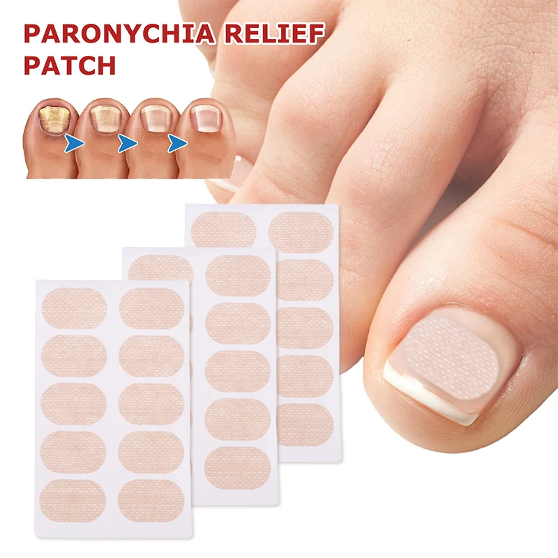 10ชิ้นสติกเกอร์แก้ไขเล็บเล็บเท้าคุด Onychomycosis ซ่อมแซมแพทช์ paronychia รักษากู้คืนเครื่องมือทำเล็บเท้า