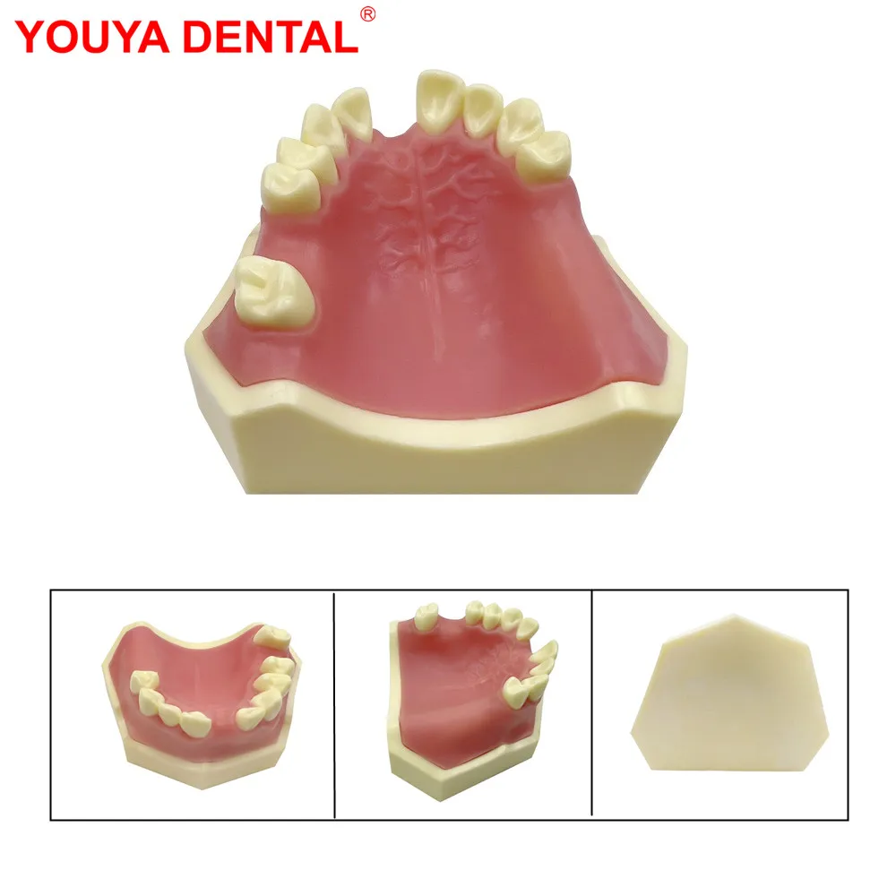 

1pc Dental Implant Model Practice Teeth Model For Dental Students Dentist Studying Training Examation Dentistry Teaching Product