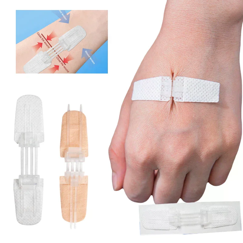 Zipper Band Aid Painless Wound Closure Patch Sterile Sutureless Dressing Flexible Medical Plaster for Kids and Adults