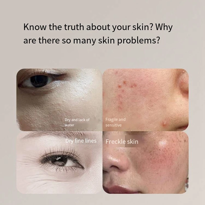 BABZ-nouveau détecteur de peau, testeur Facial Portable facile à utiliser, analyseur de teneur en huile de peau pour Salon de beauté Spa maison