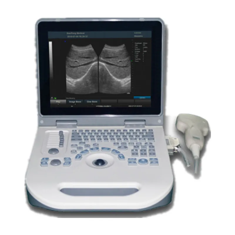 Portable Color Echocardiography Cardiac Machine Ultrasound Scanner