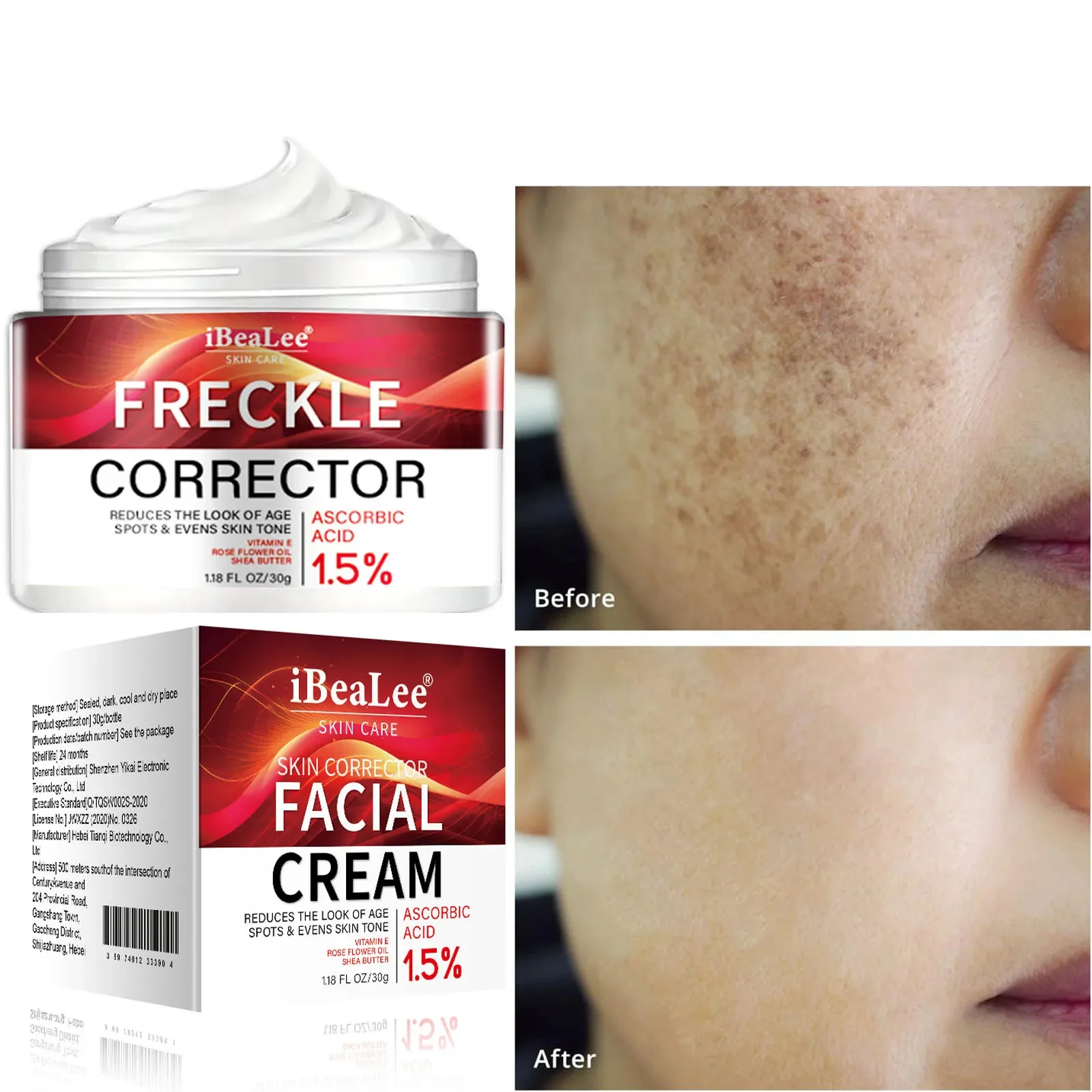 Crema Facial para eliminar puntos negros, Corrector de pecas, blanquea el melasma, antimanchas marrones, aclara la pigmentación, hidrata el cuidado de la piel Facial