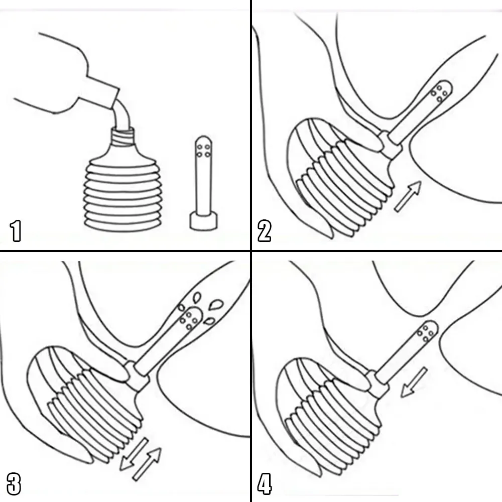 100 مللي قابلة لإعادة الاستخدام الطبية المهبل الري قابل للسحب المهبل الشرج الدوش المؤنث النظافة حقنة شرجية نظافة البلاستيكية المستقيم حقنة