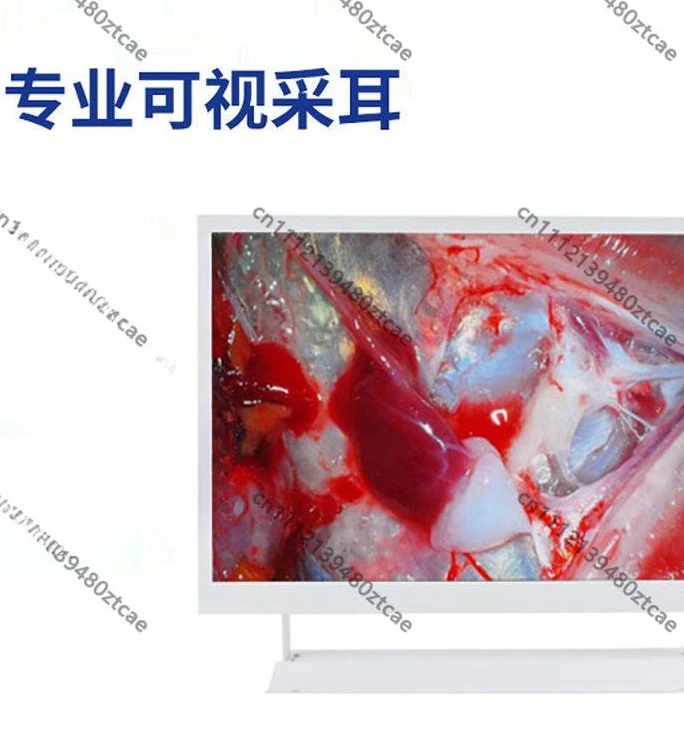 21.5 Inch White  Endoscope Monitor Freeze Frame Function for Visual Ear Inspection