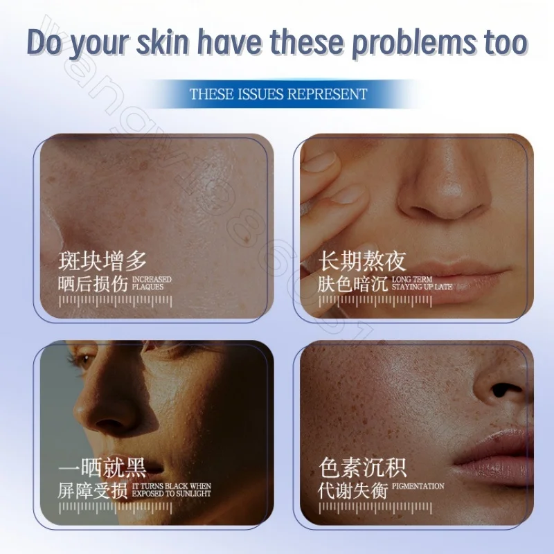 377 Krem Rozjaśniający Koloryt Skóry 60g Skuteczny i Szybki Rozjaśnianie Kolorytu Skóry Redukcja Melaniny Melasma Krem Nawilżający