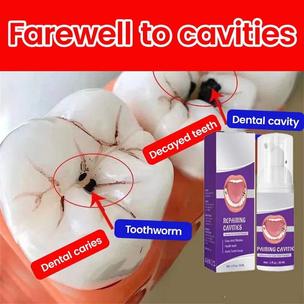 Effective Teeth Whitening Tooth decay repair  Calculus Plaque Periodontitis Remove Cavities