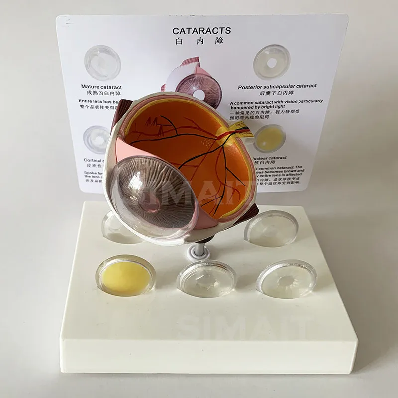 Cataract Eye Model, Chip Iris Organ Anatomy Optical Teaching Props