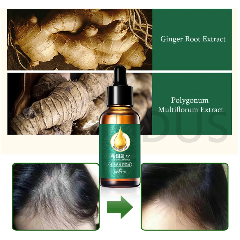 6 pcs Ginger Hair Treatment Essence Fast Hair Growth Anti Preventing Hair Loss Regrowth Serum Liquid Anti-Hair Loss for Women am