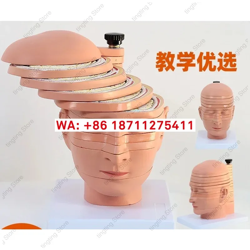 Brain tomographic anatomy model Human brain slice model Head cross-section imaging Brain nerve function teaching aids