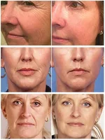 Collagen Face Serum Cream Set Anti-Aging Firming Lifting Fine Line Deep Anti Sagging Wrinkle Brighten Beauty Skin Care Products 2