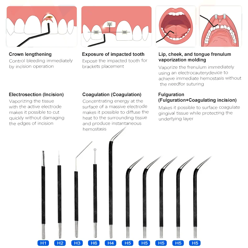 20W Dental Electrosurgical Unit, Portable Electric Surgery Scalpel Knife for Professional Use