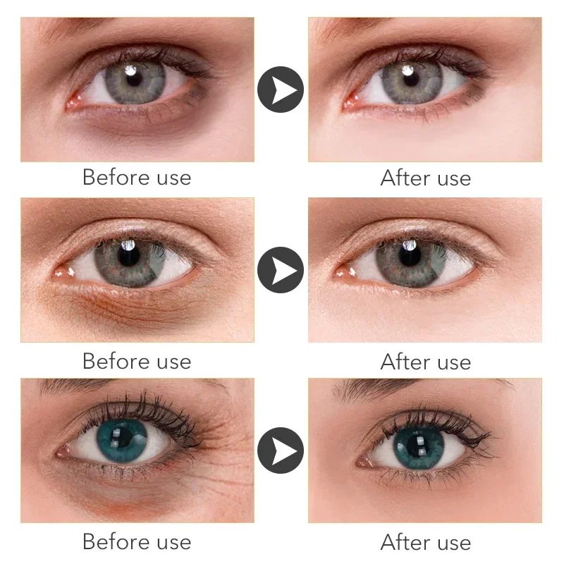 Crema de ojos para eliminar arrugas instantáneas, antienvejecimiento, elimina las ojeras, bolsas de ojos, hinchazón, desvanece las líneas finas, masajea el cuidado coreano