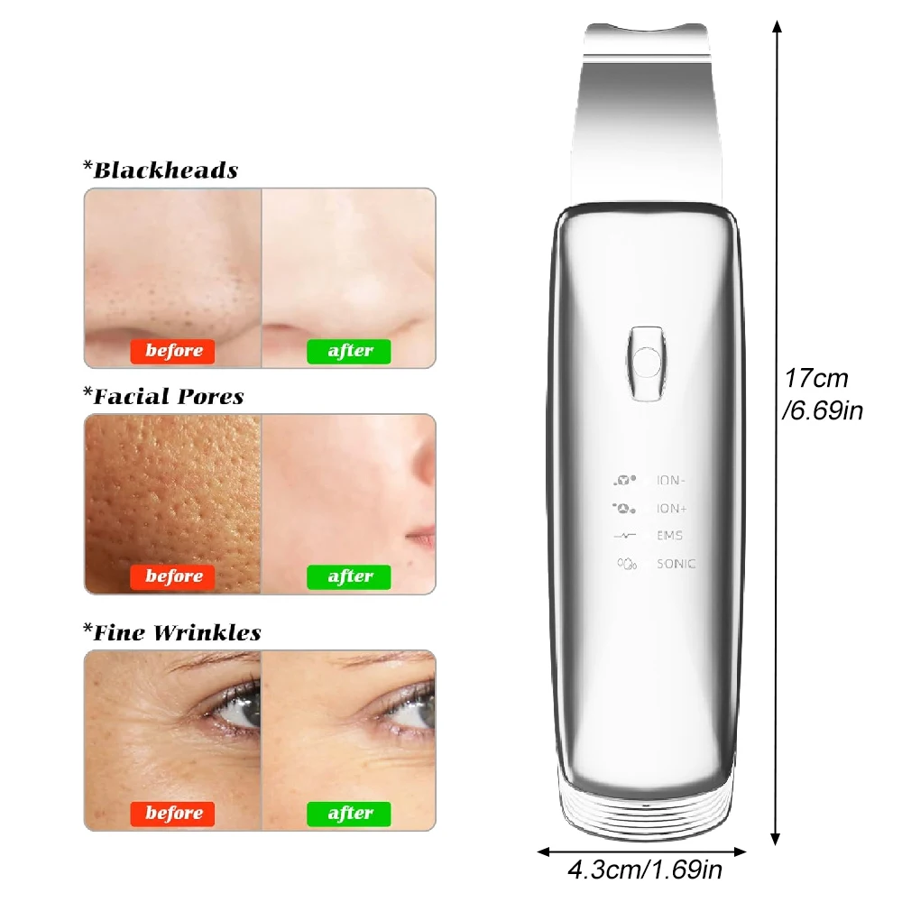STAWHO 1Set 4-in-1 Sonic Facial Spatula | for Deep Cleansing, Pore Extraction, Serum Infusion, Anti-Aging and Contouring