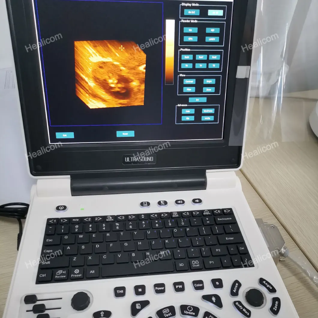 Factory Direct Ultrasound Machine USG PC Platform Full Digital B&W Ultrasound Diagnosis System