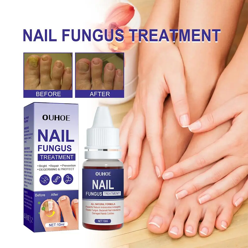 Effective Nail Fungus Treatment Oil Foot Nail Repair Toenail Cuticle Remover Oil Anti Infection Toenail Fungus Treatment10ML