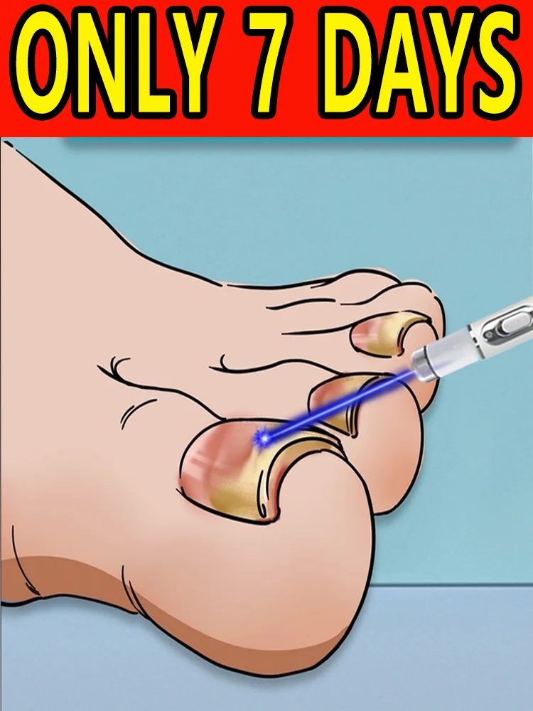 

Синий свет устраняет грибные инфекции и восстанавливает здоровые ногти.