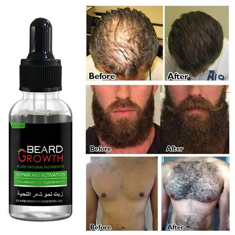 Natural Men\'s Beard Essential Oil Hair Loss Treatment Quick Growth Repair Maintenance Nourish Ginger Vitamin E Beard Care 30ml