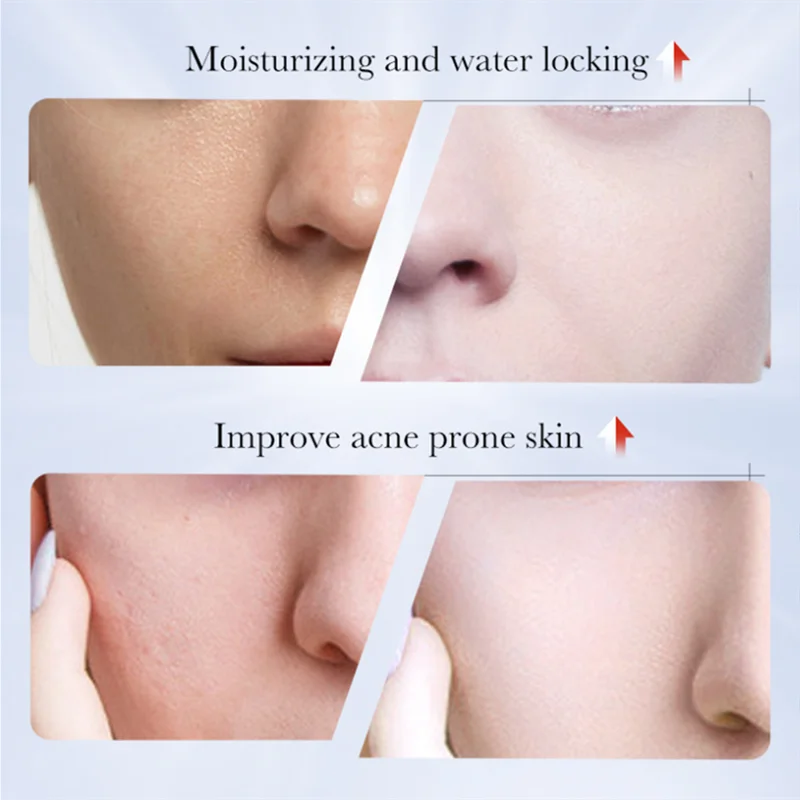 30G Whitening Freckle Cream  Kojic Acid Dark Spot Remover Skin Care Moisturizing Brighten Anti-aging Fade Spot Face Beauty