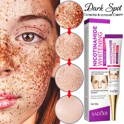 Nicotinamide Whitening Freckle Removing Cream Effectively Remove Melasma Dark Spot Acne Marks Lightening Melanin Face Skin Care