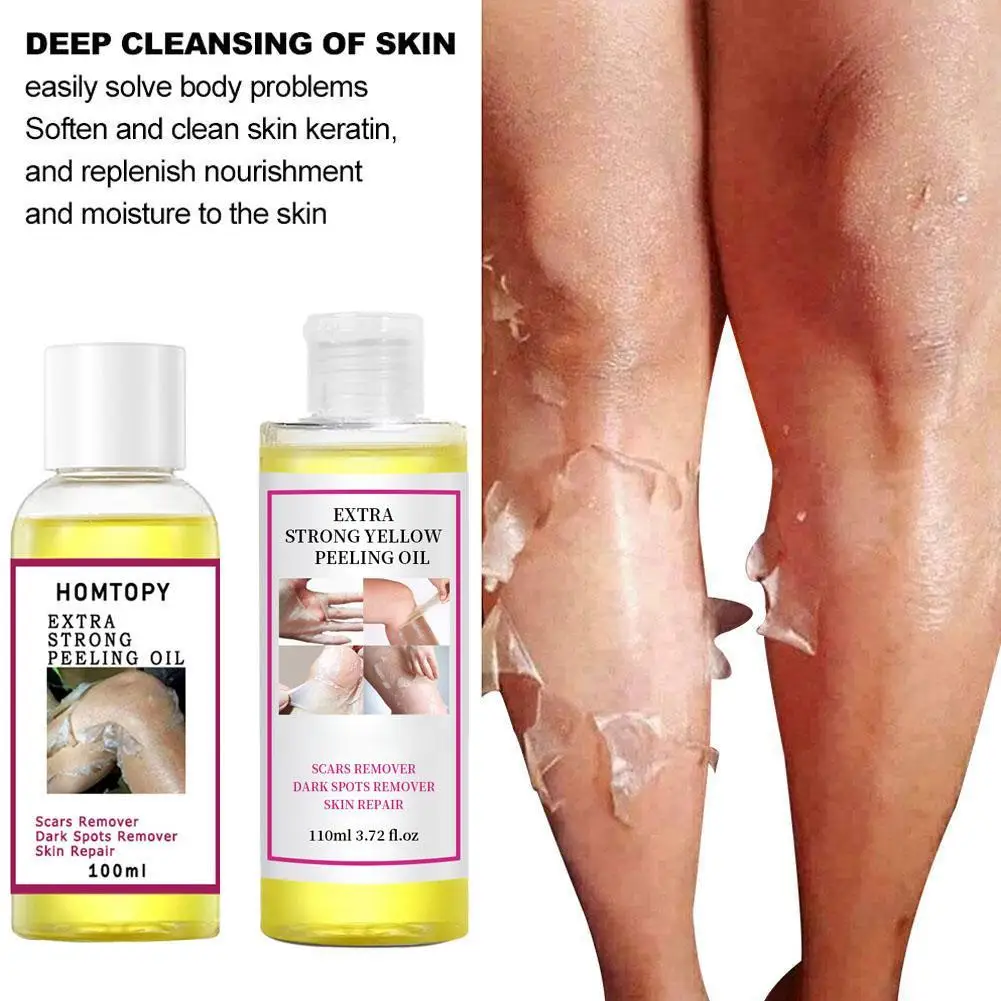 

Strong Yellow Peeling Oil Bleach Dark Skin Whiten Lotion Lighten Body Elbow Knee Hand Exfoliate Dead Skin Nourish Even Skin Tone