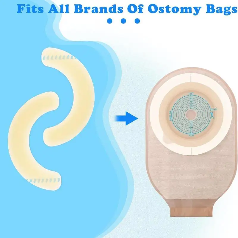 1/4 Pcs Elastico Strisce Barriera per Stomia Idrocolloide Impermeabile Perdite Adesivo per la Pelle Nastro Barriera per Stomia per Sacchetto di Colostomia