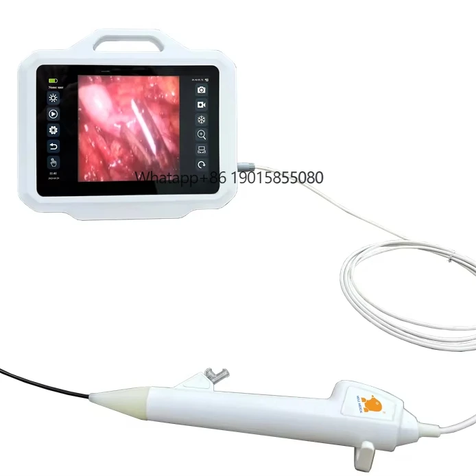 

New Design Medical Equipments Endoscope Factory Price Ureteroscope Flexible Disposable Ureteroscopy Uroscope