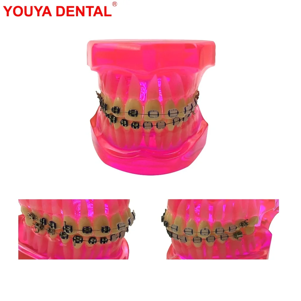 Dentistry Orthodontic Model Typodont Half Metal Half Ceramic Ortho Dental Teeth Model For Studying Teaching Patient Education