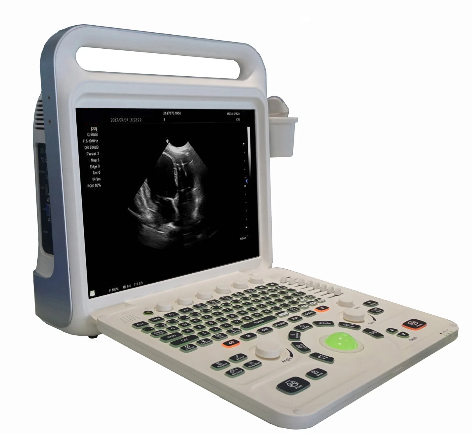 High Quality Diagnostic System Medical Equipment Portable 15inch Color Doppler Ultrasound Machine