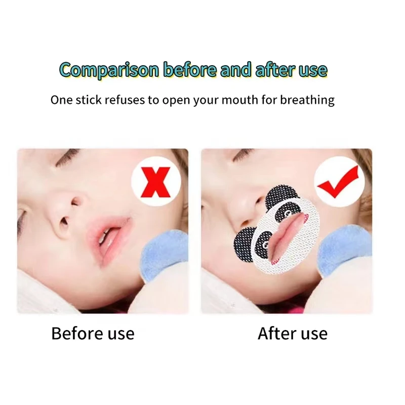 30PCS Kids Cartoon Anti-Snoring Stickers Sleeping Closed-mouth Stickers Breathing Correction Patch Shut Up Patch Orthosis Tape