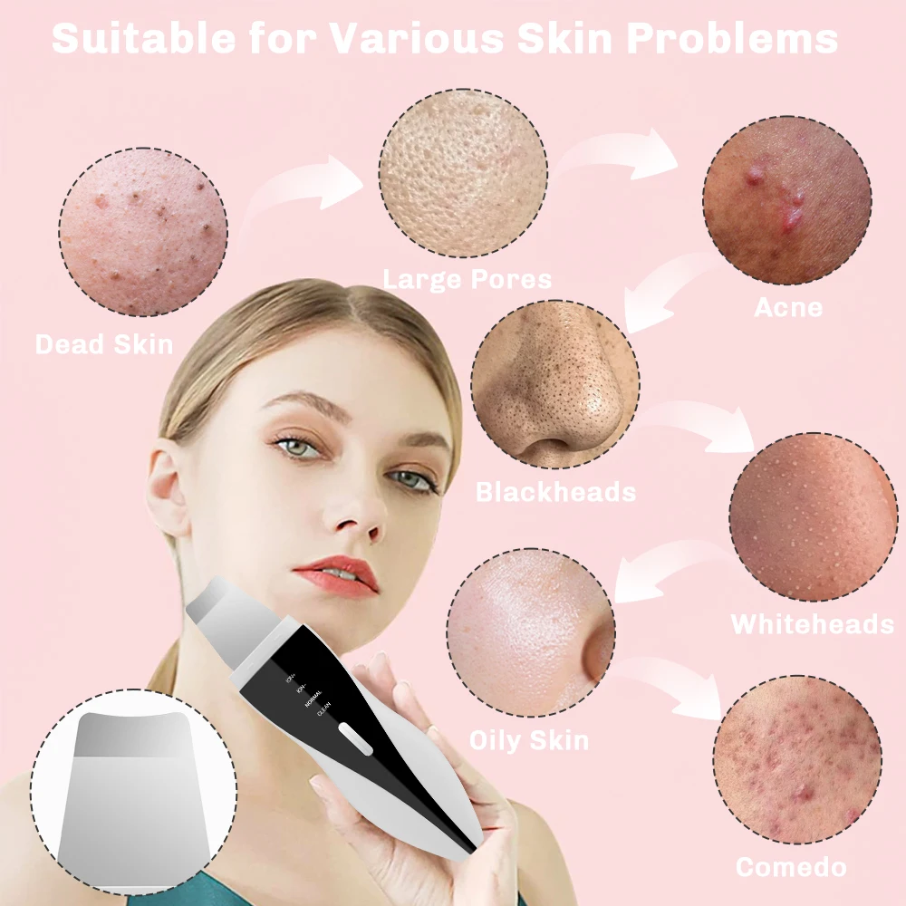 Ultrasonic Cleaning Machine Face Skin Spatula Scrubber Ionic Cleaner Facial Exfoliator Scraper Blue Red Light Blackhead Remover