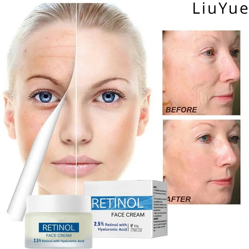 

Feminine Brightening Cream Lighten Fine Line Pigmentation Improve Melasma Firming Facial Skin Moisturizing Mild Essence Lotion