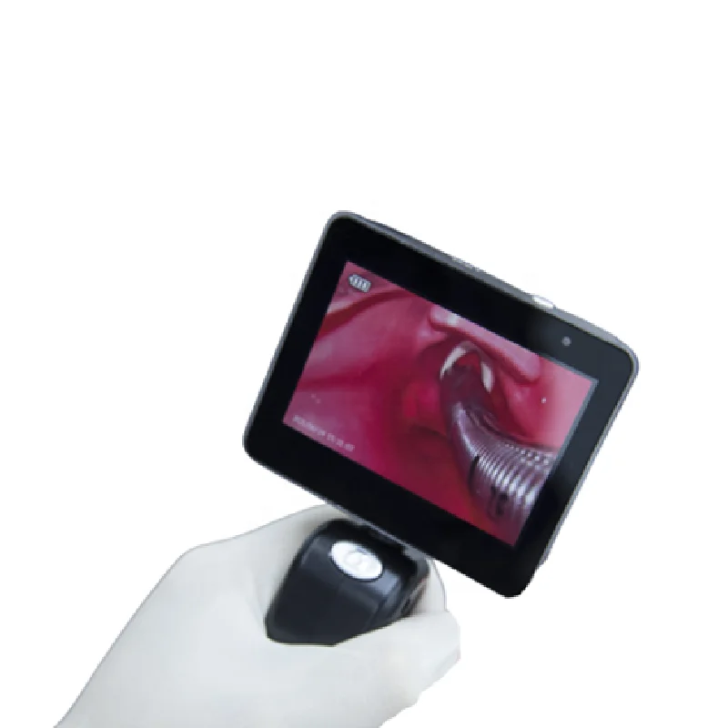 

Medical grade Portable Medical Visual laryngopharyngeal mirror 3 inch OLED screen video Laryngoscope for ENT