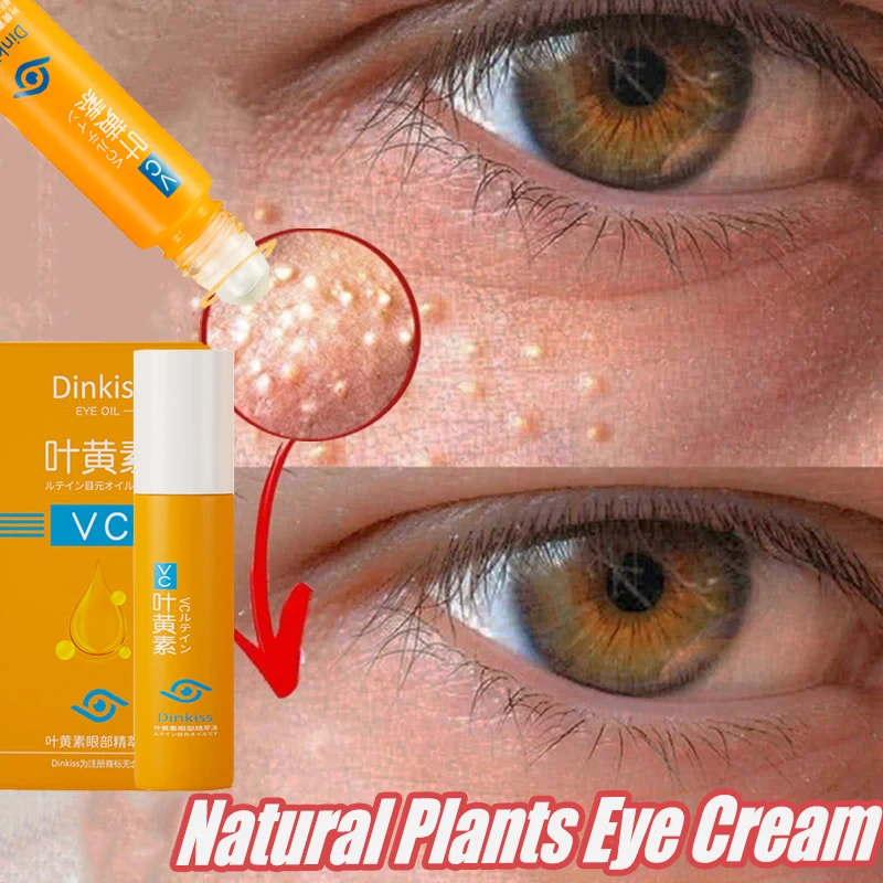 Fat Granules Remover Eyes Serum Remove Dark Circles Eye Bags Anti-Puffiness Wrinkles Lift Firming Fade Fine Lines Eye Skin Care