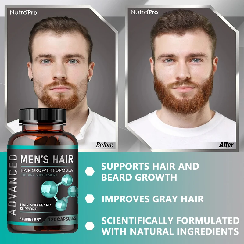 Hair Vitamins for Men - Thick Hair & Beard - Biotin & Saw Palmetto - 120 Capsules