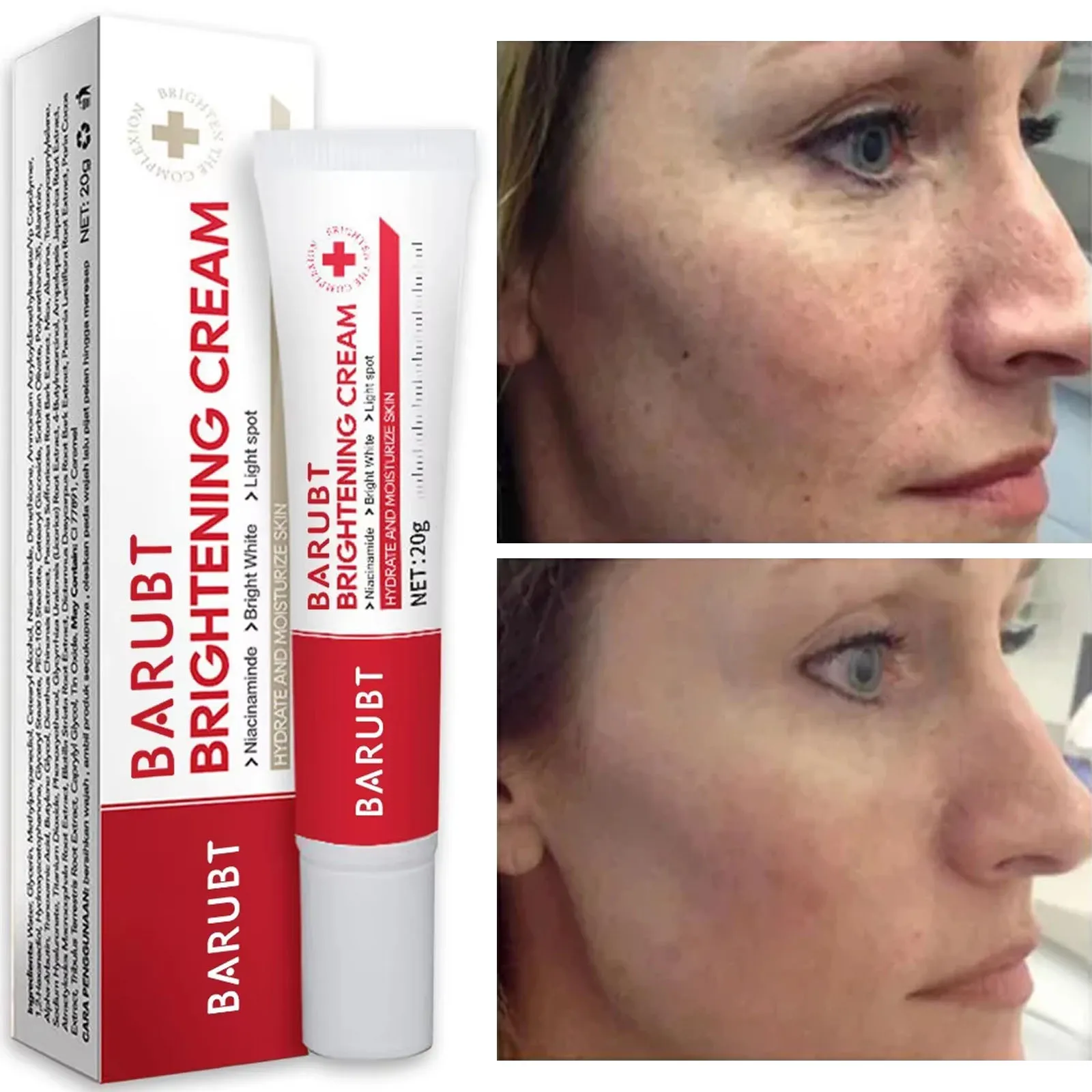 

Whitening Freckle Face Cream Brightening Skin Melasma Dark Spots Pigmentation Removal Product Fade Stain Melanin Repair Care 20g