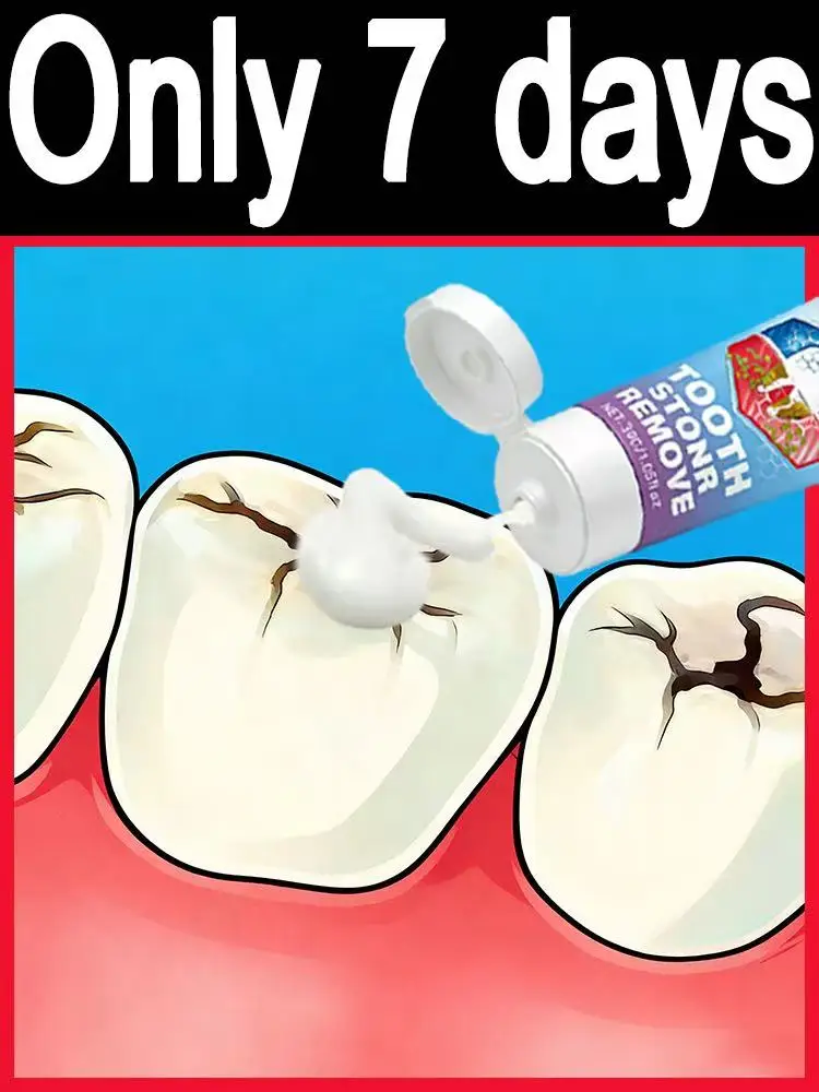 

Sᴄɪᴇɴᴛɪғɪᴄ Cᴀᴠɪᴛʏ Rᴇᴘᴀɪʀ, Tʜᴏʀᴏᴜɢʜ Pʟᴀᴏ̨ᴜᴇ Cʟᴇᴀɴɪɴɢ, Vɪsɪʙʟᴇ Tᴇᴇᴛʜ Wʜɪᴛᴇɴɪ Let your smile shine with full confidence