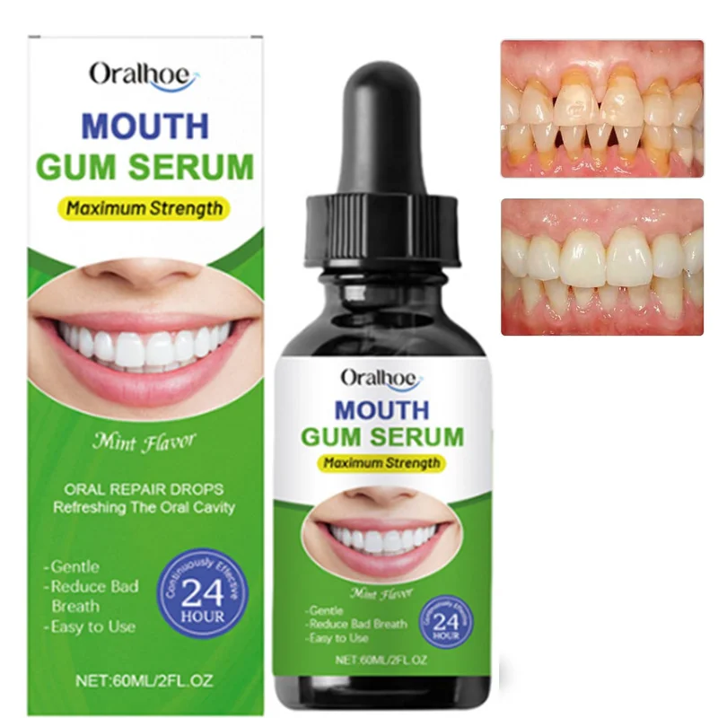 Gum Restore Drops Gum Repair for Receding Gums Stain Removal Bad Breath Treatment Cleaning Teeth Whitening Liquid for Adults