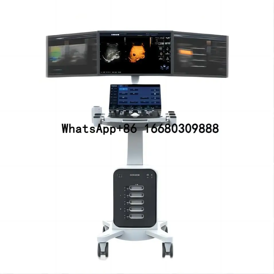Cart-based Ultrasound Machine CHISON SonoMax 7 Stationary Ultrasound Scanner Precision Diagnostics for Healthcare Providers